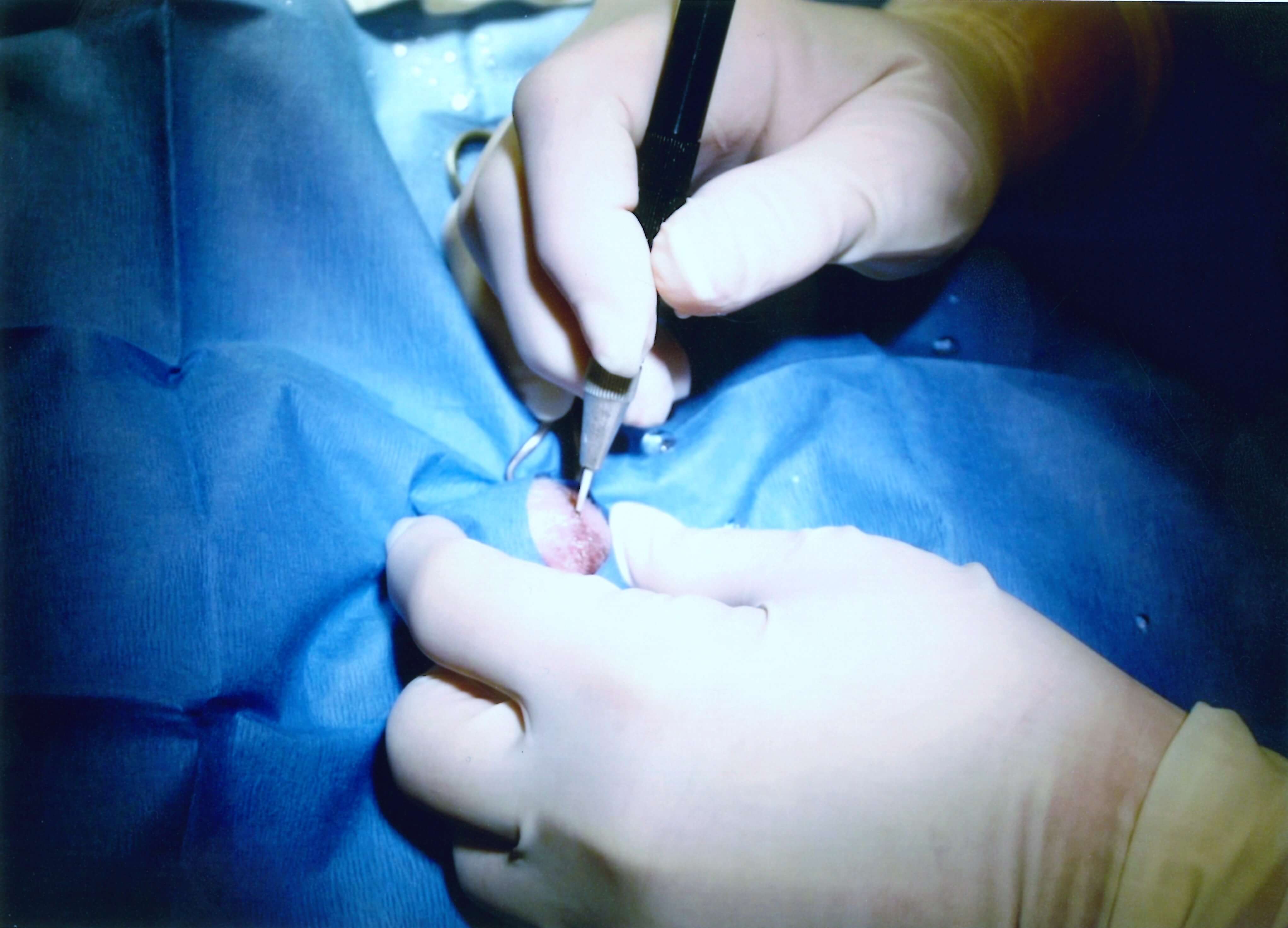 Veterinarian performing neuter with laser